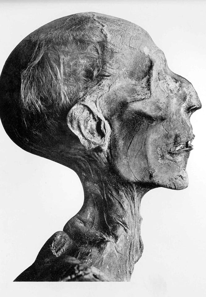 Photographie ancienne du profil de la momie de Ramsès II